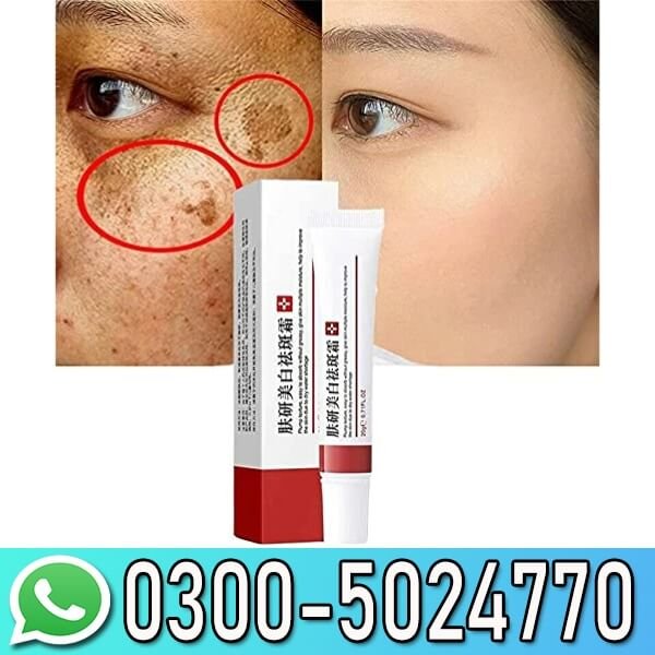 Dmy Cream 20gm In Pakistan