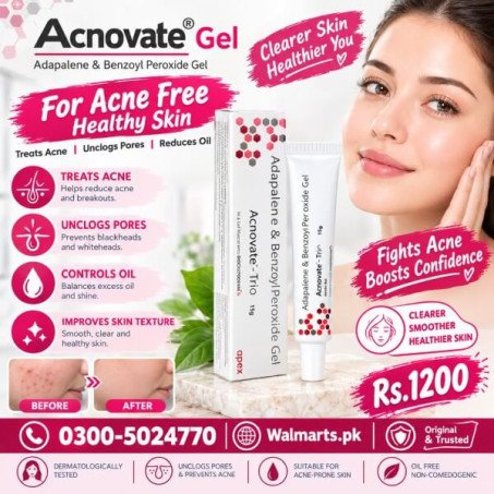 Acnovate Gel In Pakistan